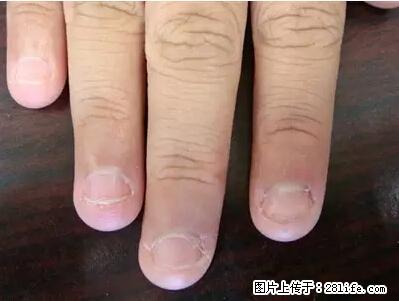 剪指甲、挖耳屎，这些日常小动作竟隐藏大危害！ - 衡水生活资讯 - 衡水28生活网 hs.28life.net